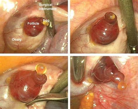 human egg visible|Human egg makes accidental debut on camera